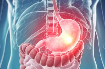 Gastrointestinal Sistem Kanser Cerrahisi